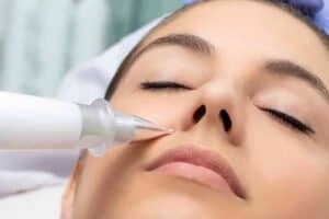 Best Actinic Keratoses Removal 3 Actinic keratoses Shropshire solutions - book in today!